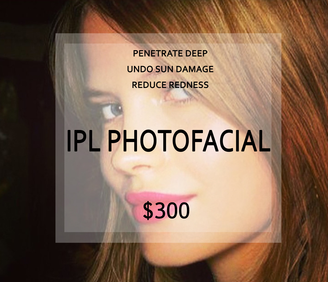IPL PhotoFacial (1 hour)